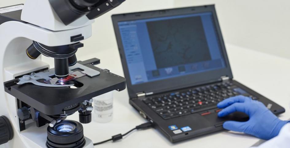Análisis de bacterias en un microscopio computarizado en PaxVax Berna