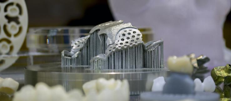 Jaw implant from the 3D printer: The new Swiss m4m Center wants to bring additive manufacturing for medical technology to Swiss industry. Image: Marina Skoropadskaya, iStockphoto