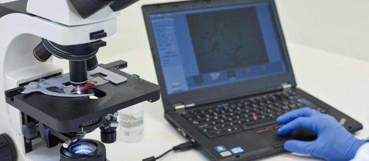 Análise bacteriológica com computador microscópio em PaxVax Berna