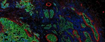 Biomarkers create a tumor’s cellular landscape. 