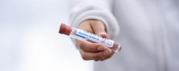 Covid-19 antibodies test