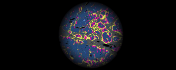This discovery provides insight into the complex ecosystem of the tumor microenvironment and offers a new perspective on the treatment of cancer, particularly in the field of oncology.