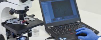Analisi di batteri sotto un microscopio computerizzato a PaxVax Berna